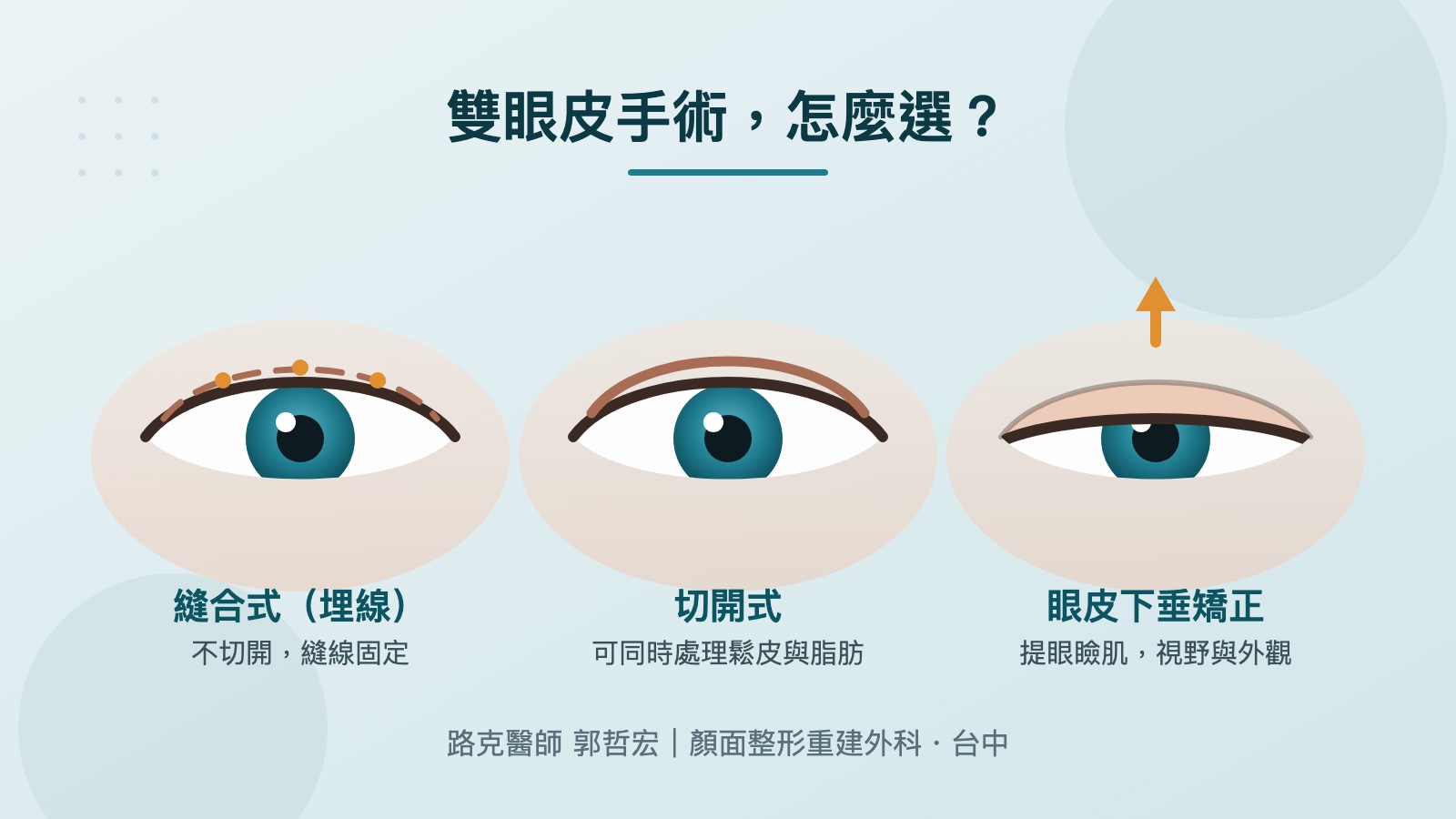 台中雙眼皮手術完整說明｜縫合式・切開式・眼皮下垂